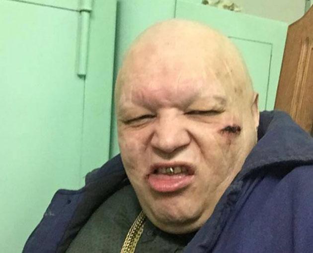 Барецкий предложил Соседову бой после его «наезда» на НТВ