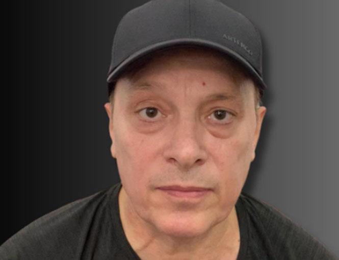 Андрей Разин решил летом сделать операцию по подтяжке век Андрей Разин решил летом сделать операцию по подтяжке век