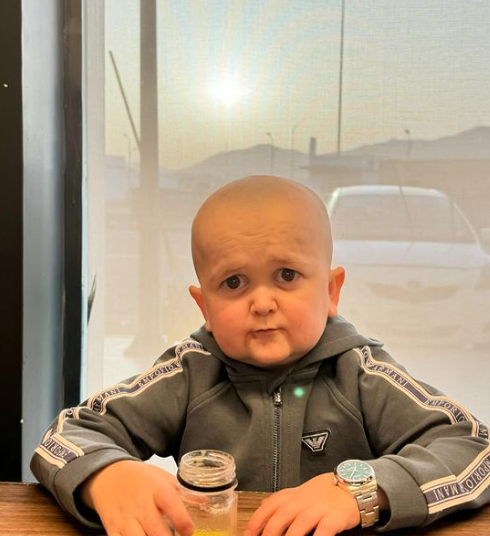 Блогер Хасбик поделился с подписчиками фотографией с обритой налысо головой