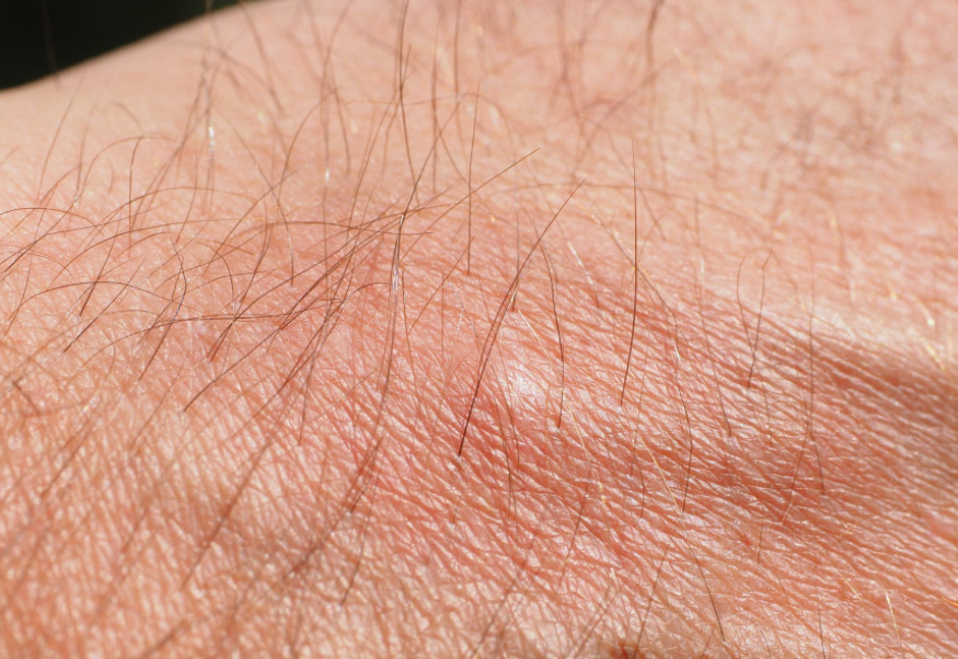 Аллерголог Быков объяснил россиянам, как справиться с аллергией