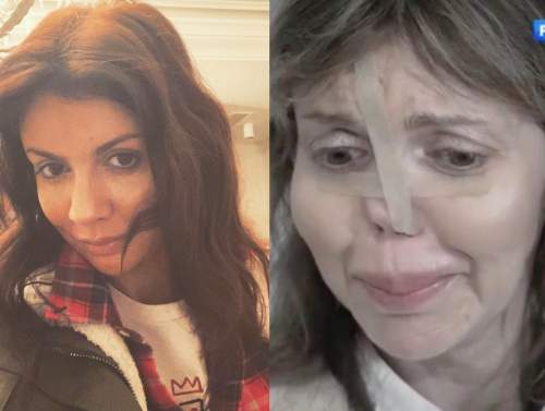 «Разрушение было стремительным»: Алиса Аршавина озвучили причину, по которой она лишилась носа «Разрушение было стремительным»: Алиса Аршавина озвучили причину, по которой она лишилась носа