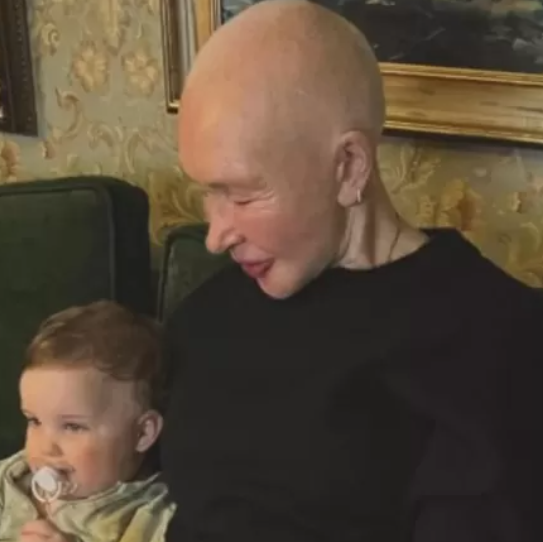 Невестка показала Татьяну Васильеву с лысой головой