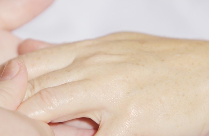 Дерматолог Егорова объяснила, почему появляются пятна на руках