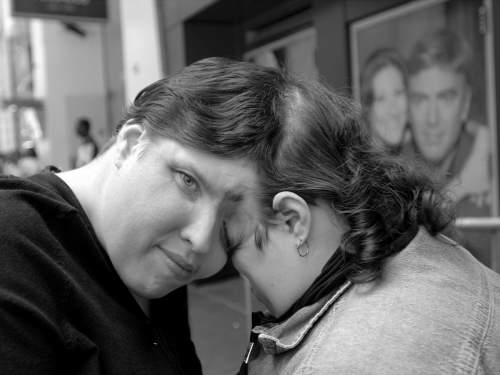 Умерли старейшие в мире сиамские близнецы