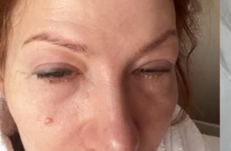 Блёданс столкнулась с жуткими последствиями публичной поддержки Пугачёвой Блёданс столкнулась с жуткими последствиями публичной поддержки Пугачёвой