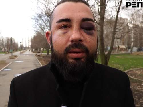 В Саратовской области мигранты избили азербайджанца за поддержку СВО, приняв его за русского (ФОТО, ВИДЕО) В Саратовской области мигранты избили азербайджанца за поддержку СВО, приняв его за русского (ФОТО, ВИДЕО)