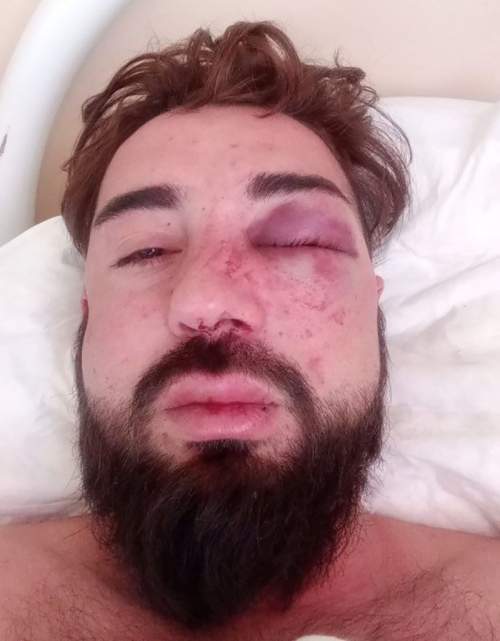 В Саратовской области мигранты избили азербайджанца за поддержку СВО, приняв его за русского (ФОТО, ВИДЕО) В Саратовской области мигранты избили азербайджанца за поддержку СВО, приняв его за русского (ФОТО, ВИДЕО)