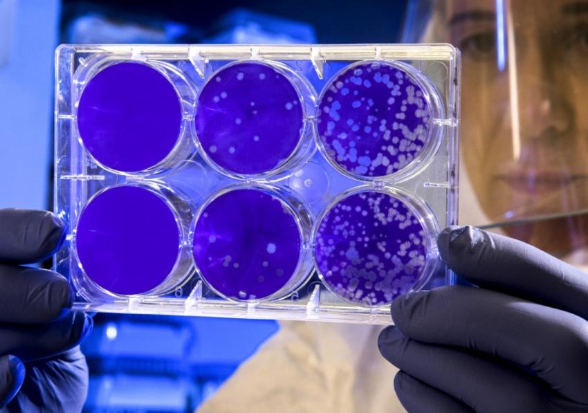 Ученые предупредили о превращении COVID-19 после новой мутации в «гробовирус»