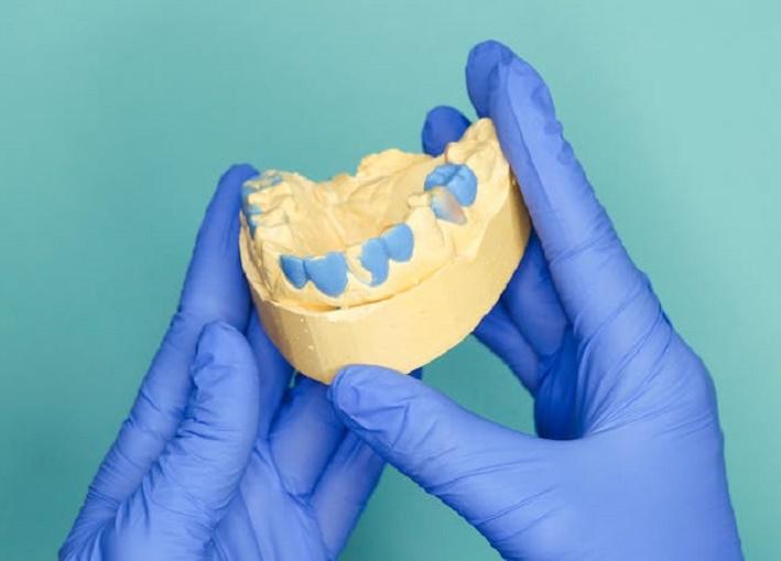 Имплантолог Дахкильгов назвал причину открывания челюсти со звуком