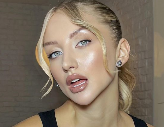 Марго Овсянникова рассказала о последствиях пластической операции у Хайдарова