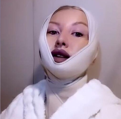 Марго Овсянникова рассказала о последствиях пластической операции у Хайдарова