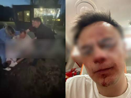 Футболистов «Енисея» обвинили в пьяной драке с постояльцами базы отдыха в Красноярске (ВИДЕО)