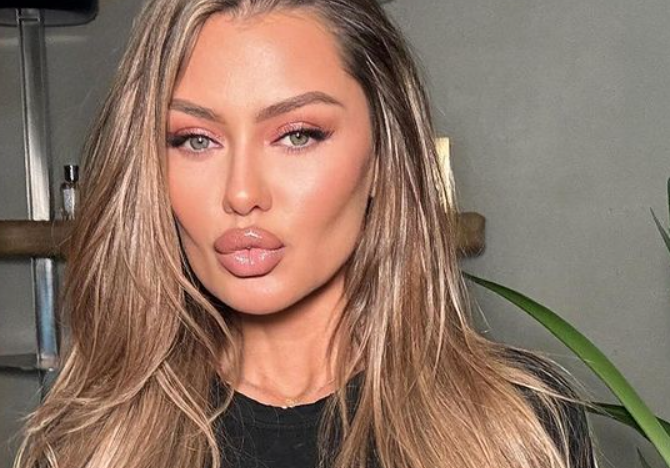 Боню хотят лишить родительских прав из-за внешности её дочери