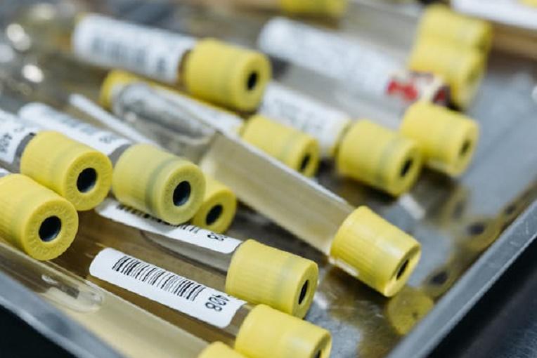 Эндокринолог Терушкин составил ТОП-10 бесполезных анализов