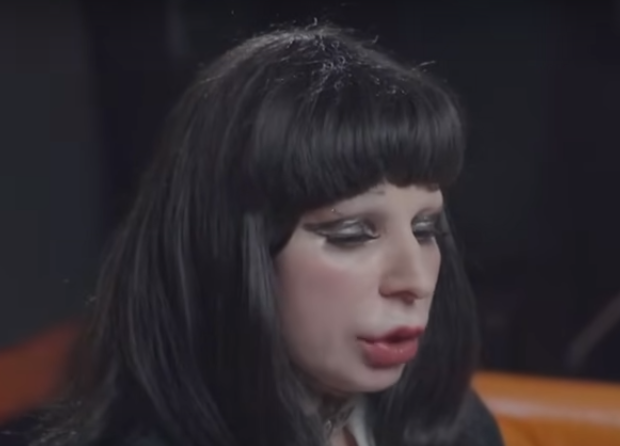 Врач Володченков заподозрил Агузарову в блефаропластике из-за пластыря на глазу