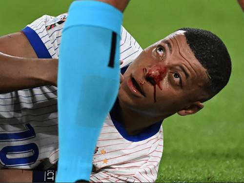 Мбаппе сломали нос и увезли на скорой на матче Евро  2024 (ВИДЕО)