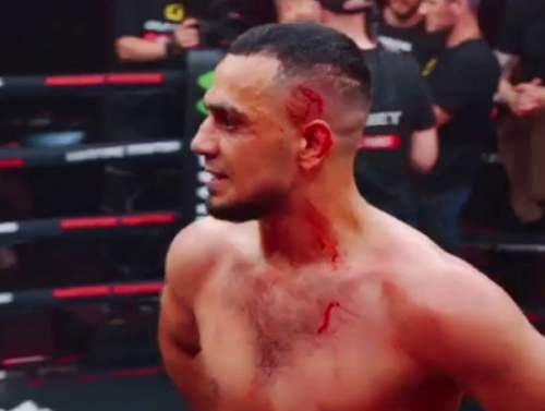 Боксер из Азербайджана, назвавший соперника «русской свиньей», дважды извинился перед РФ (ВИДЕО) Боксер из Азербайджана, назвавший соперника «русской свиньей», дважды извинился перед РФ (ВИДЕО)