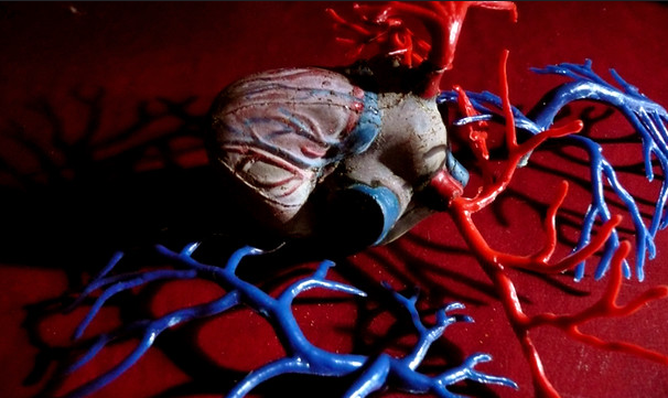 В Великобритании девочку с половиной сердца лечили препаратами для эрекции