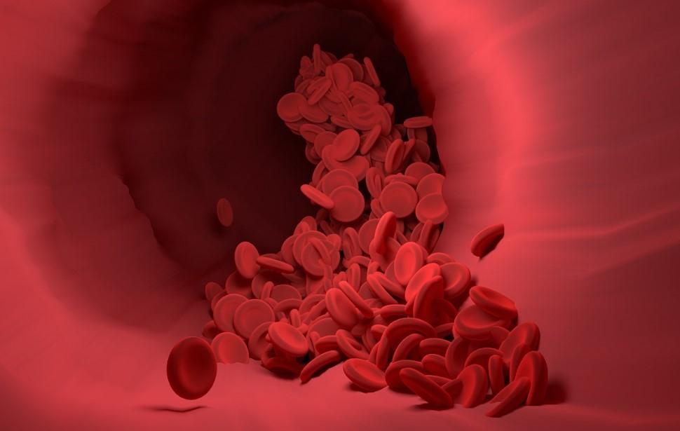 Флеболог Смирнова: Одышка и боль в груди указывают на оторвавшийся тромб