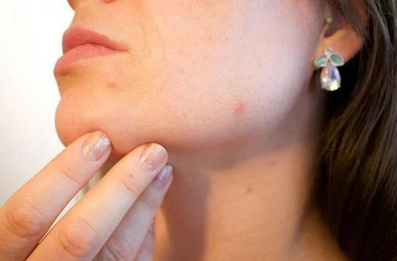 Косметолог Носарева объяснила, как предотвратить утренний отек лица