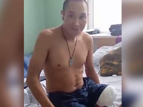 «Титановый герой»: раненый российский военный, сидевший в окопе 17 дней, сам отрезал себе ногу (ВИДЕО)