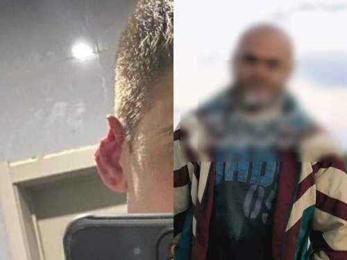 Мигрант в Приамурье откусил ухо мужчине и лишился гражданства РФ (ФОТО, ВИДЕО) Мигрант в Приамурье откусил ухо мужчине и лишился гражданства РФ (ФОТО, ВИДЕО)