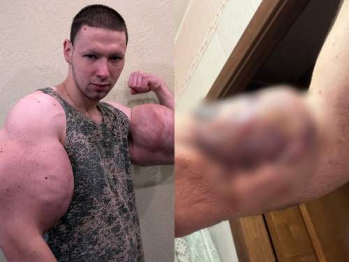 «Прости меня, Боженька»: фрик-блогер Руки-Базуки рассказал про сложную операцию (ФОТО)