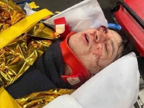 Главный &laquo;герой&raquo; &laquo;голой вечеринки&raquo; рэпер VACIO шокировал фанатов новым видео после &laquo;падения с крыши&raquo; (ФОТО, ВИДЕО)