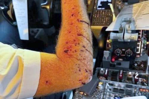 В небе над США в Boeing 737 попал метеорит: последствия ЧП сняли на фото (ФОТО)