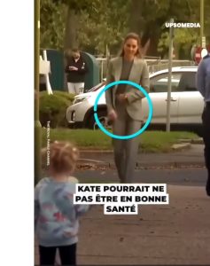 В Сети из-за фото заподозрили, что Кейт Миддлтон установили стому (ФОТО)