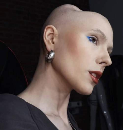 «Я сражалась до последнего»: умерла блогер Ирина Небога (ФОТО)