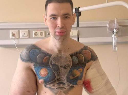 СМИ: блогеру Руки-Базуки грозит скорая ампутация конечностей (ФОТО)