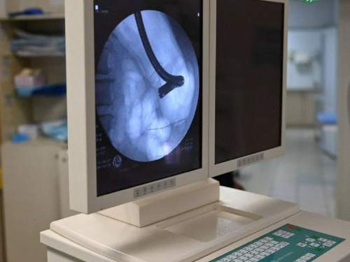 Уральский Минздрав поиздевался над пенсионеркой, которая чуть не погибла из-за сосиски (ФОТО)