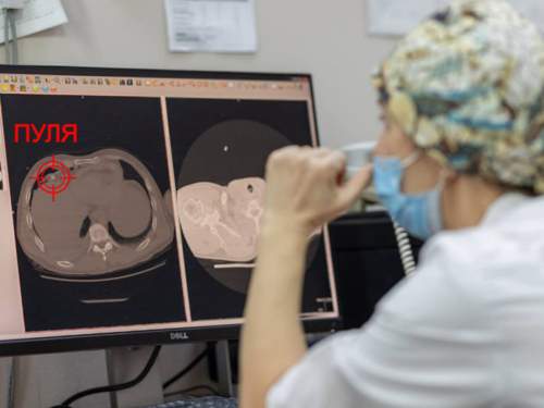 Уралец с огнестрельным ранением в сердце выжил после 38 минут клинической смерти