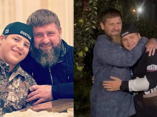 «Cломана челюсть и рваные раны»: СМИ узнали о состоянии Адама Кадырова после ДТП (ФОТО)