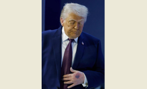 Трамп объяснил, откуда у него появляются чудовищные синяки на руках (ФОТО)